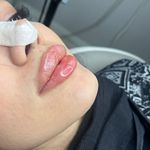 کلینیک زیبایی و مرکز لیزر لاوین