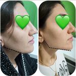 کلینیک زیبایی و مرکز لیزر لاوین