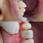 کلینیک دندان پزشکی و ایمپلنت الیسو