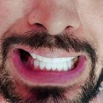 لبخند زیبا و جذاب