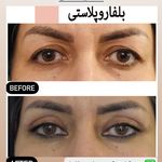 کلینیک زیبایی ژل و بوتاکس و لیزر آلبا