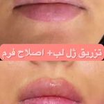 کلینیک زیبایی ژل و بوتاکس و لیزر آلبا