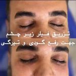 کلینیک زیبایی ژل و بوتاکس و لیزر آلبا