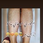 اپلاسیون بدن وتتو دائم