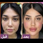 مرکز پوست و لیزر  سایناشور آمریکا دلدار