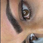 میکروبلیدینگ فیبروز تخصصی