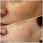 فیشیال / خدمات پوست / سالن زیبایی