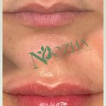کلینیک پوست،مو،زیبایی و مرکز لیزر نوژا