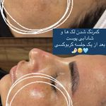 کلینیک فیشال و ماساژ سارن اسکین سارا