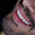 دکترای پروتزهای دندانی اکبری