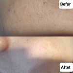 مطب زیبایی الیماه