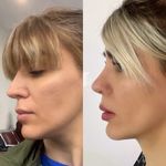 دکتر علی رضا کامیابی جراح زیبایی بینی