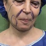 کلینیک زیبایی الماس کاملا اقساطی