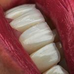 دندانپزشکی و ایمپلنت دکتر مهدی کریمی