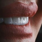 دندانپزشکی و ایمپلنت دکتر مهدی کریمی