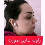 دکتر زیبایی بوتاکس دکتر شیرین امیر حسنی