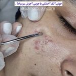 فیشال و پاکسازی تخصصی پوست سولماز