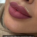 کلینیک زیبایی پوست ومو ولیزر پرمیس