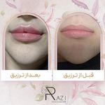 کلینیک پوست و مو رازی