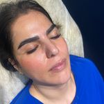 کلینیک زیبایی الینا رز