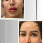 کلینیک فیشیال و پاکسازی پوست صبا