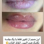 مژگان اسکین کرMojgan skincare