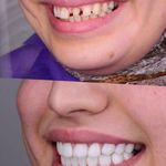 دندانپزشکی رز (اقساط و بیمه تکمیلی)