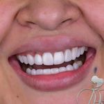دندانپزشکی رز (اقساط و بیمه تکمیلی)