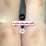 کلینیک زیبایی، لیزر و تخصصی زنان نفس