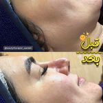 فیشال تخصصی  سعیده صدیقی