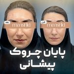 کلینیک زیبایی مانشید