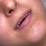 کلینیک تخصصی پوست و زیبایی ملینا