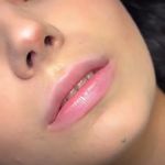 کلینیک تخصصی پوست و زیبایی ملینا