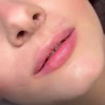 کلینیک تخصصی پوست و زیبایی ملینا