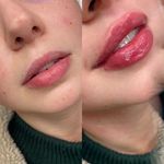 مرکز زیبایی,بوتاکس و لیزر آروشا