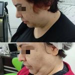 کلینیک پوست مو و لیزر و زیبایی بهرویان