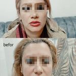 کلینیک پوست مو و لیزر و زیبایی بهرویان