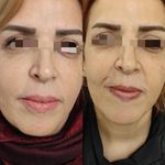 کلینیک پوست مو و لیزر و زیبایی بهرویان