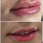 کلینیک پوست مو و لیزر و زیبایی بهرویان