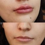 کلینیک پوست مو و لیزر و زیبایی بهرویان