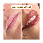 مرکز زیبایی مونا یزدانی VIP سعادت آباد