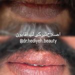 کلینیک زیبایی دکتر هدیه دهقانپور