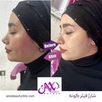 کلینیک زیبایی آنا بیوتی