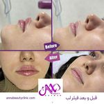 کلینیک زیبایی آنا بیوتی