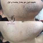 مرکز لیزر و زیبایی دایمون