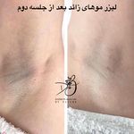 مرکز لیزر و زیبایی دایمون