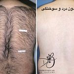 مرکز لیزر و زیبایی دایمون