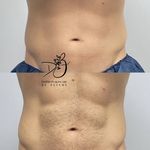 مرکز لیزر و زیبایی دایمون