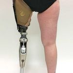 کلینیک ارتوپدی فنی مهر ( اسکن کف پا)