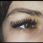 کاشت مژه پارسافر